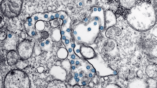 Microvascular Dysfunction in COVID-19 Patients: MYSTIC Study
