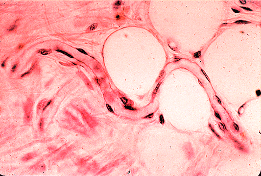 Uncoupling of Microvascular Blood Flow and Capillary Density in Vascular Cognitive Impairment