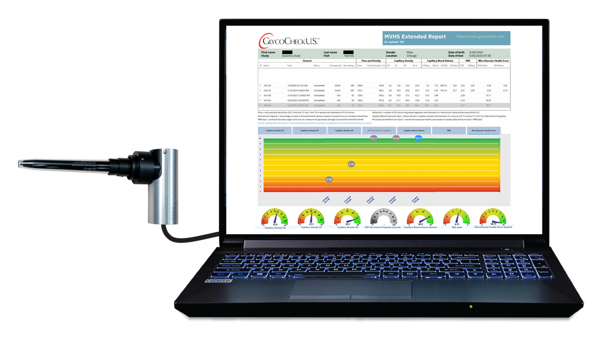 GlycoCheck camera and laptop showing a Microvascular Health Score report